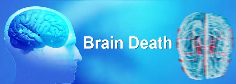 دلایل مرگ مغزی چیست؟